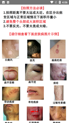 �沿Ƥ����������Ͻ�ͼ4