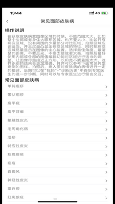 �沿Ƥ����������Ͻ�ͼ2