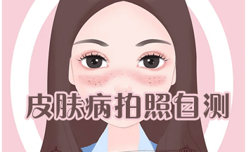 ��������ʶ��Ƥ�������APP_��������ʶ��Ƥ����_Ƥ���������ѯƽ̨