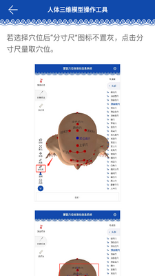 ��ҽѨλ��׼����Ϣϵͳapp��ͼ3