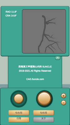 CAGS������Ӱģ������ͼ1