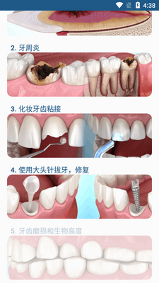 ����3Dͼ��ѧϰ������Ѱ�(Dental Illustrations)��ͼ1