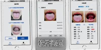 AI����ɨ����TongueApp���°棬��ҽ���ʱ�ʶ�������
