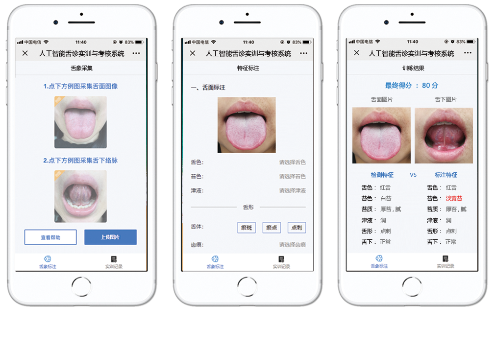 AI舌诊扫描仪TongueApp最新版下载安装教程注意事项