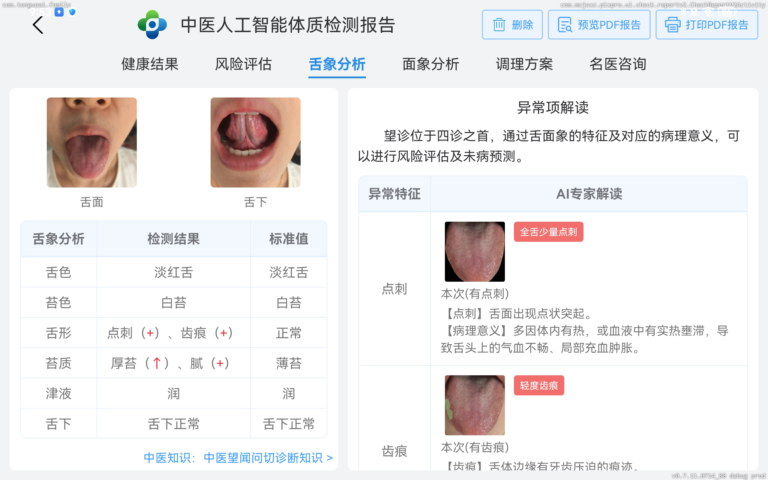 AI舌诊扫描仪TongueApp最新版中医体质辨识报告解读与建议