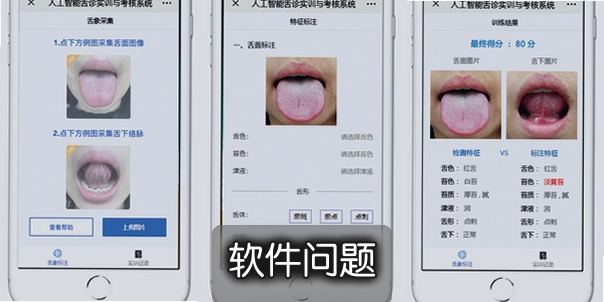 AI����ɨ����TongueApp���°����أ���ҽ���ʱ�ʶ�뽡������