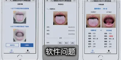 AI舌诊扫描仪TongueApp最新版下载,中医体质辨识与健康分析