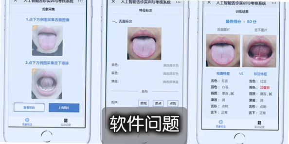 AI����ɨ����TongueApp���°棬������������������
