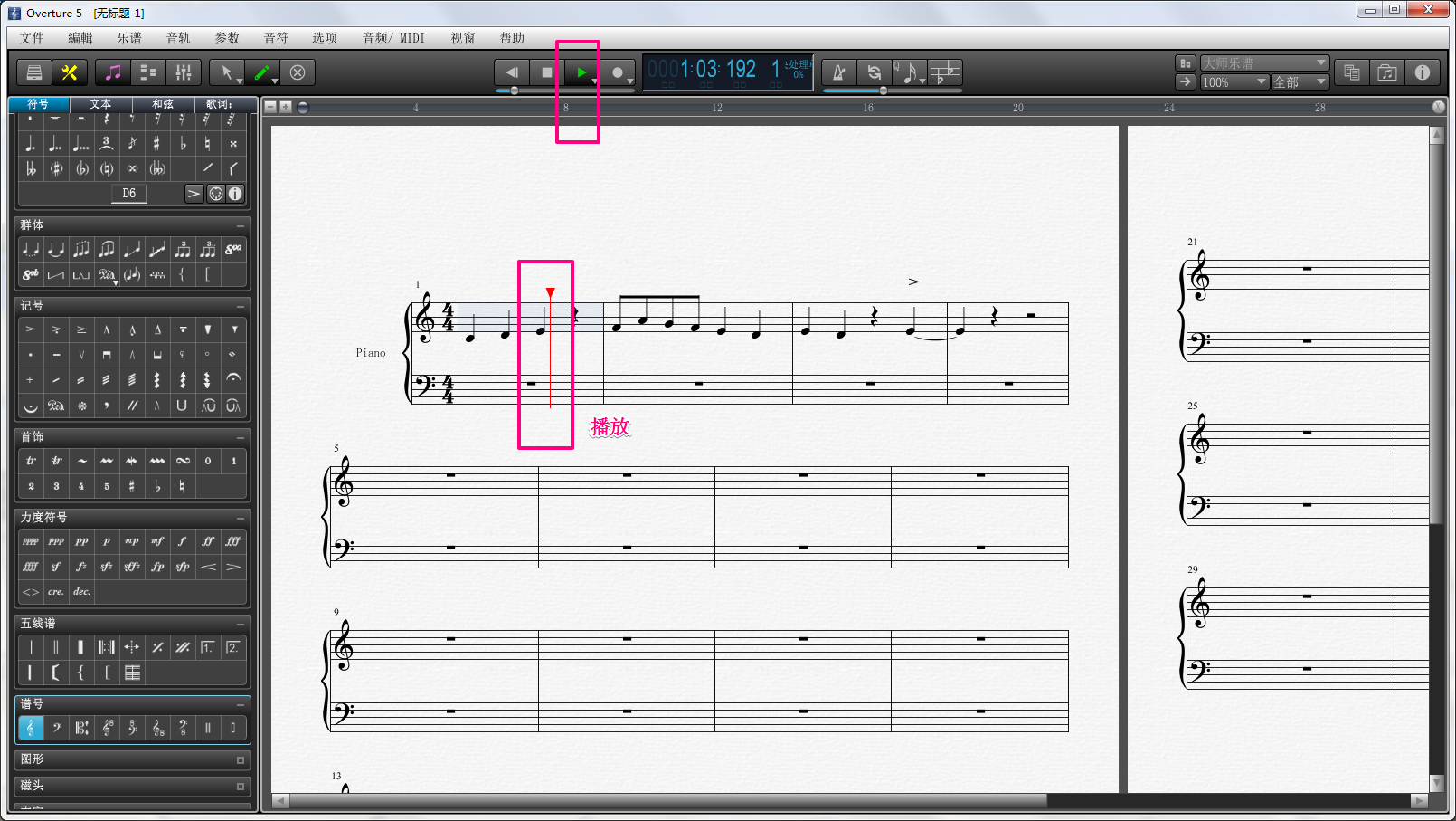 Overture �������� ��׿�� �̳�