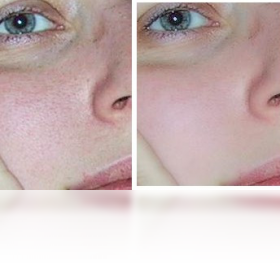 CleanSkinFX ��׿�� ��������